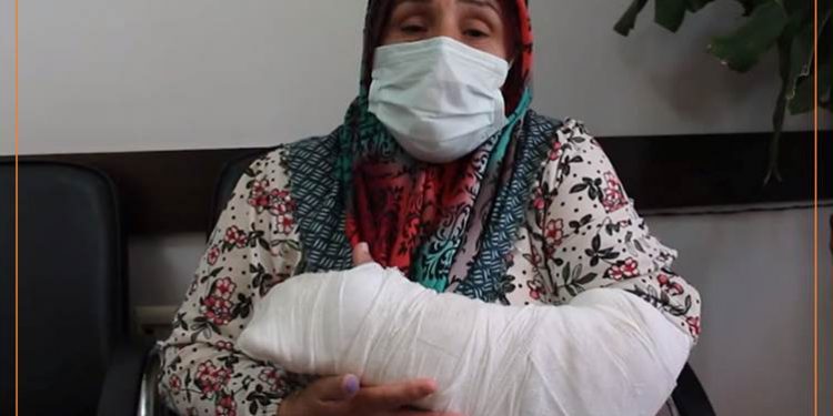 Diyarbakır’da polisin 55 yaşındaki kadının kolunu ve dişlerini kırması Meclis’e taşındı