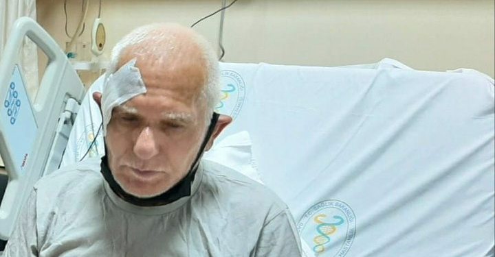 Tozkoparan’da elektrikleri kesildiği için önünü göremeyip düşen 71 yaşındaki yurttaş, beyin kanaması geçirdi!