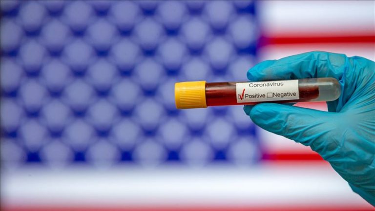 Çin: “Koronavirüs salgınının kökeninin bulunması için ABD’nin Fort Detrick laboratuvarı incelensin”