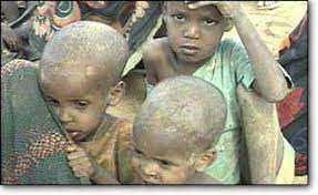 Oxfam: Dünyada, dakikada 11 kişi açlık nedeniyle hayatını kaybediyor